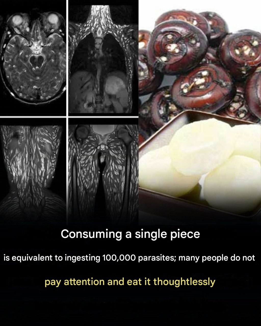 Even a single bite can be harmful: Here’s how to protect yourself from foodborne parasites.