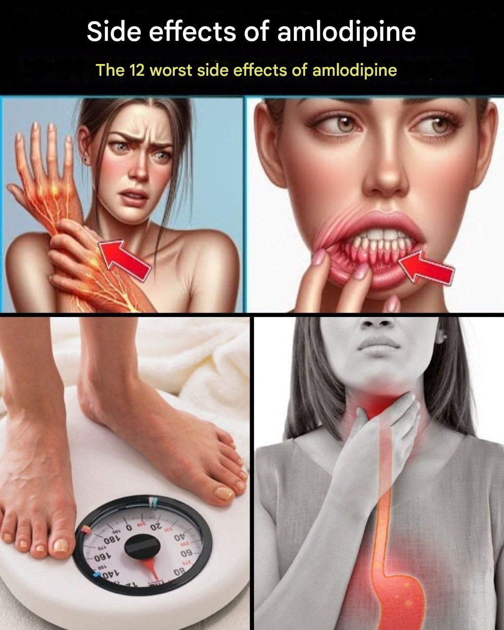 12 Worst Side Effects of Amlodipine You Should NEVER Ignore!