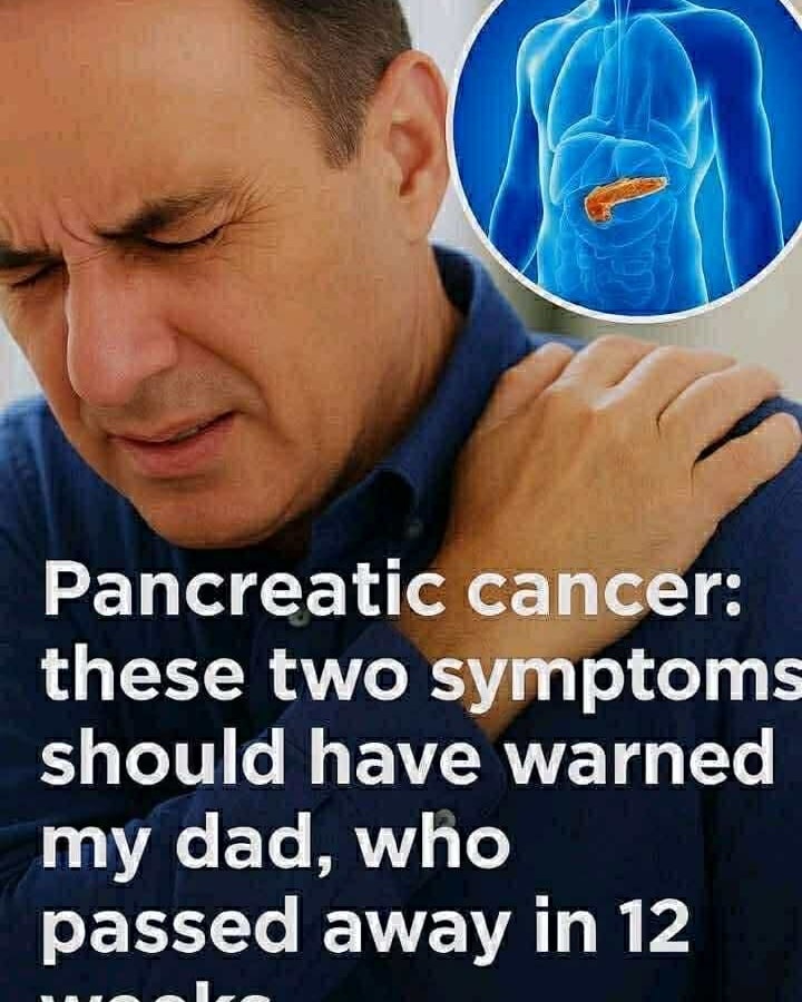 Signs of pancreatic cancer you should never ignore